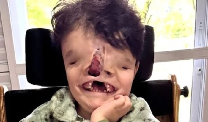 AJUDE O GUERREIRO JOAQUIM VIVER SEM DOR