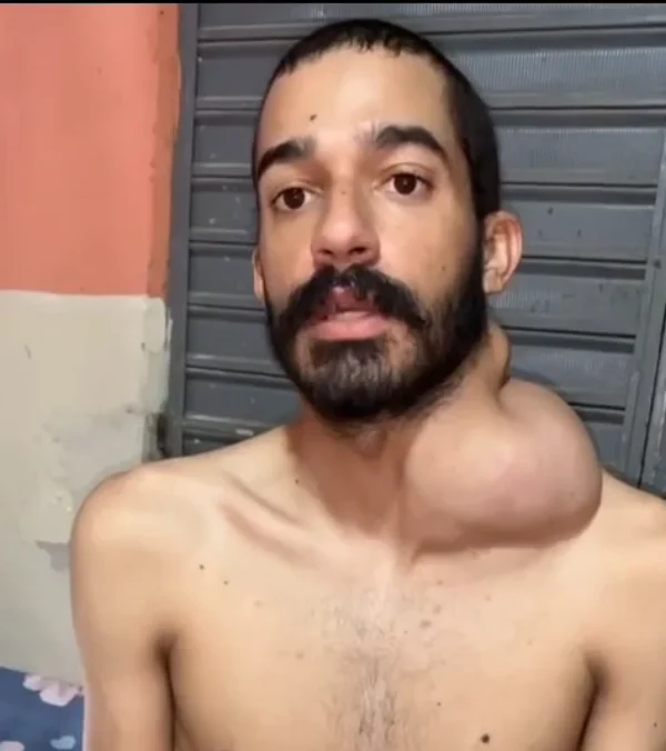 Uma Luta Pela Vida: Apoie Walison no Tratamento Contra o Câncer